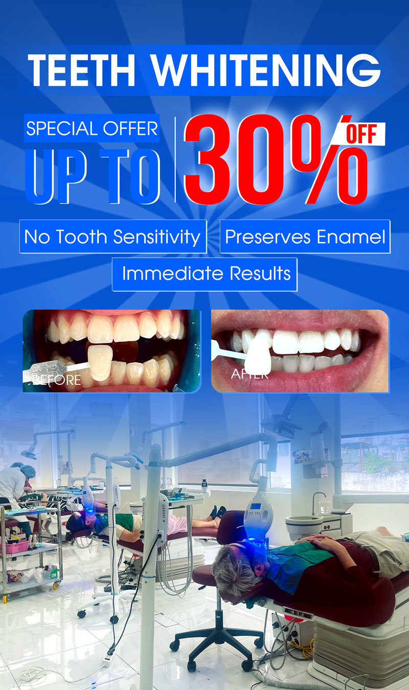 teeth whitening banner mobile new